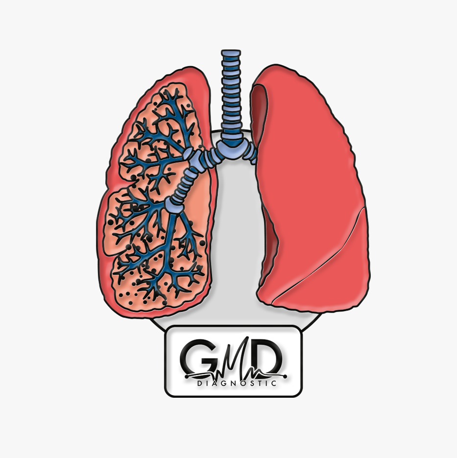 PIN PULMONES GMD