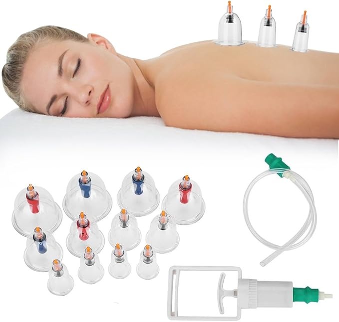 B-VENTOSA-VACUNTERAPIA-CUPPING 12 PCS REF KC-12T